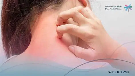 Skin Diseases: Understanding, Prevention, and Treatment by Youssef Farhat