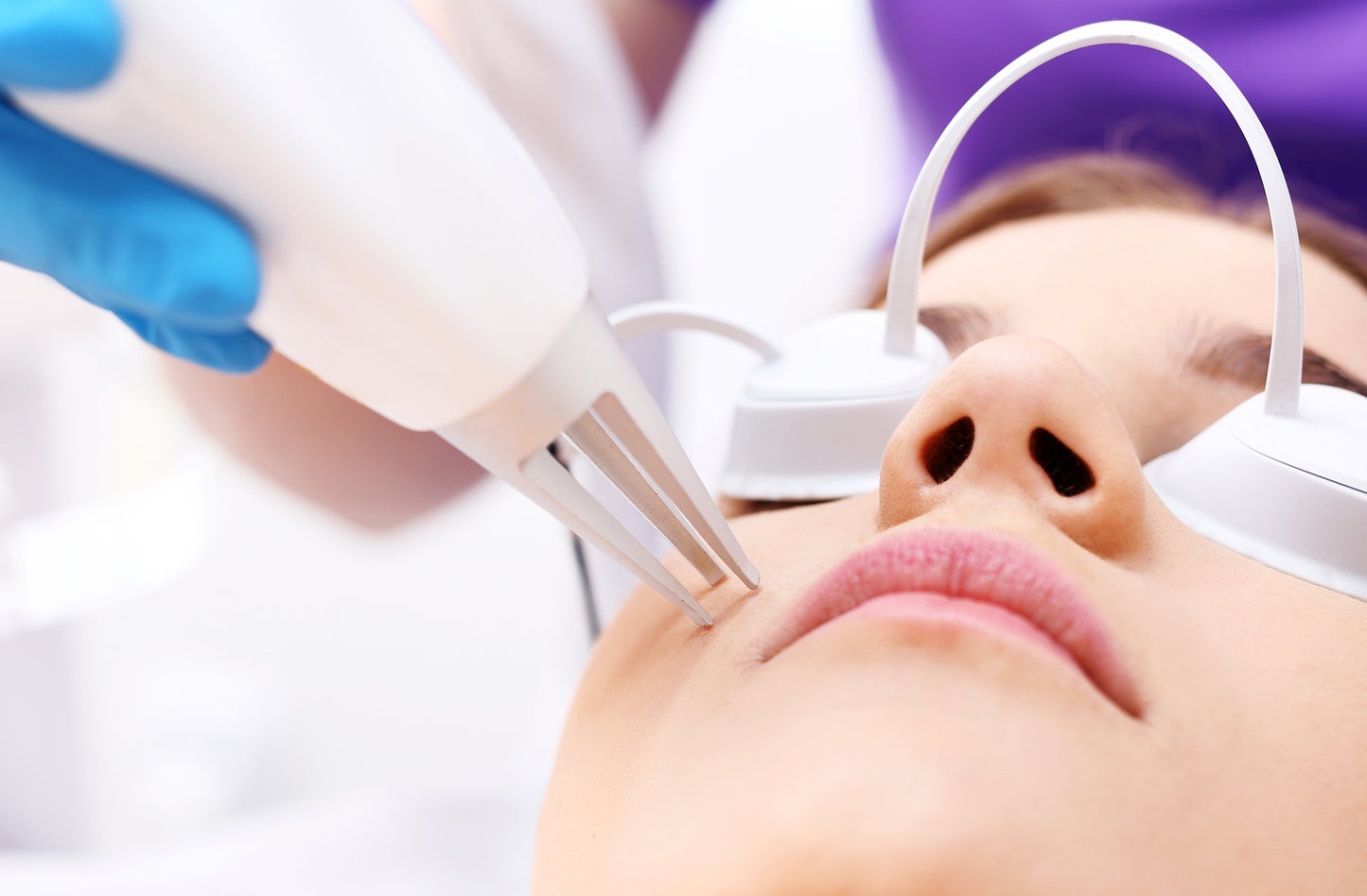 The Problem of Acne – A Concise Professional Guide