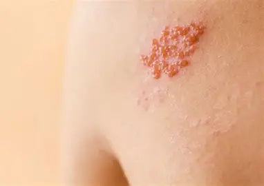 Skin Diseases: Understanding, Prevention, and Treatment by Youssef Farhat