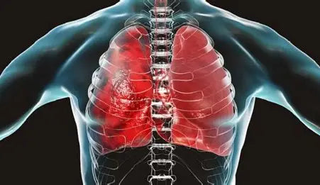 Title: The Lung Disease Problem: Understanding, Preventing, and Managing Respiratory Health Author: Youssef Farhat
