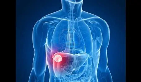 The Liver Disease Problem: Understanding and Managing Liver Health Author: Youssef Farhat