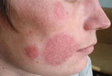 Skin Diseases: Understanding, Prevention, and Treatment by Youssef Farhat