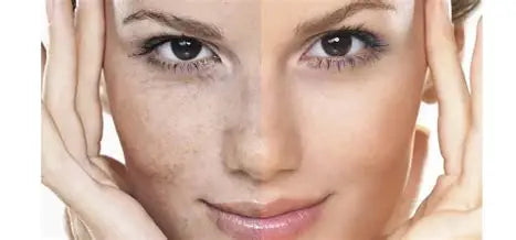 TITLE: Skin Pigmentation Disorders: Causes, Types, and Treatments Author: Youssef Farhat