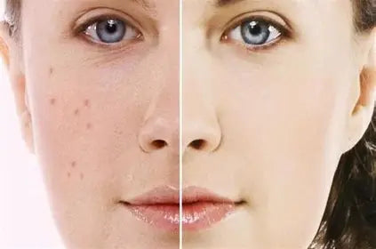 TITLE: Skin Pigmentation Disorders: Causes, Types, and Treatments Author: Youssef Farhat