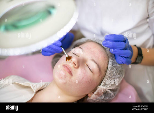 The Problem of Acne – A Concise Professional Guide