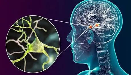 Title: Nervous System Diseases Author: Youssef Farhat