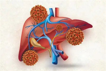 The Liver Disease Problem: Understanding and Managing Liver Health Author: Youssef Farhat