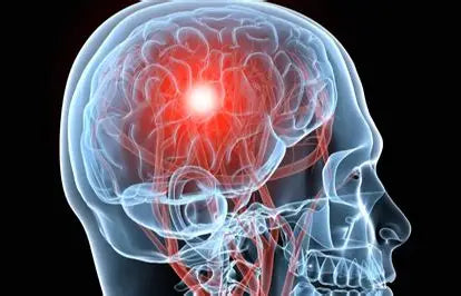 Brain Diseases: Understanding, Prevention, and Treatment Author: Youssef Farhat